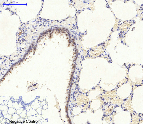 Immunohistochemical analysis of paraffin-embedded Rat-lung tissue. 1,AMPKα1/2 Polyclonal Antibody was diluted at 1:200(4°C,overnight). 2, Sodium citrate pH 6.0 was used for antibody retrieval(>98°C,20min). 3,Secondary antibody was diluted at 1:200(room tempeRature, 30min). Negative control was used by secondary antibody only.