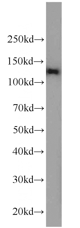 K-562 cells were subjected to SDS PAGE followed by western blot with Catalog No:107675(AARS2 antibody) at dilution of 1:3000