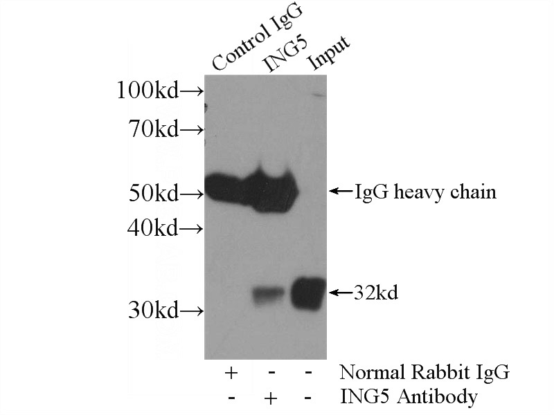 IP Result of anti-ING5 (IP:Catalog No:111797, 4ug; Detection:Catalog No:111797 1:700) with HEK-293 cells lysate 2560ug.