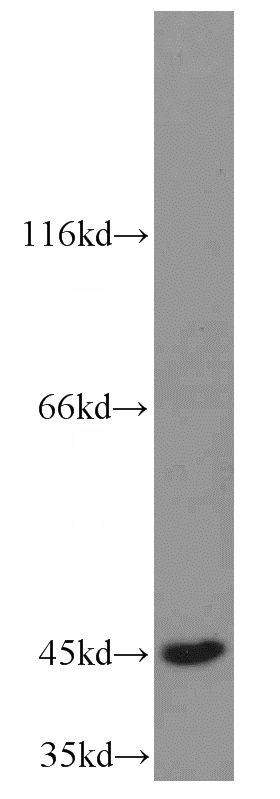K-562 cells were subjected to SDS PAGE followed by western blot with Catalog No:116451(ERP44 antibody) at dilution of 1:1500