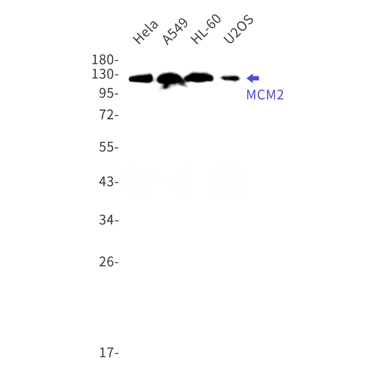 Western blot detection of MCM2 in Hela,A549,HL-60,U2OS cell lysates using MCM2 Rabbit mAb(1:1000 diluted).Predicted band size:102kDa.Observed band size:125kDa.
