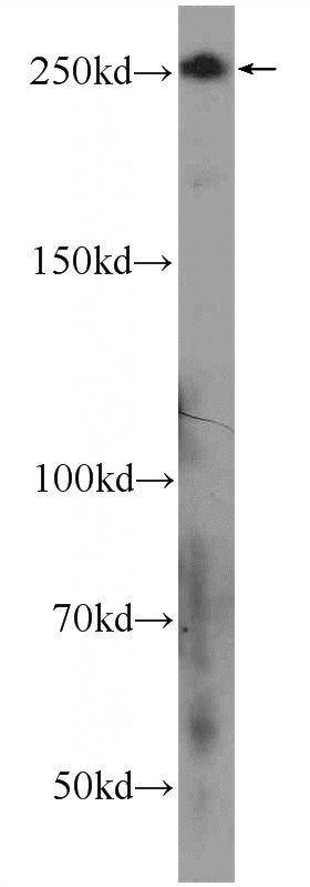 HEK-293 cells were subjected to SDS PAGE followed by western blot with Catalog No:109219(CHD3 Antibody) at dilution of 1:600