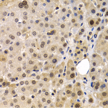 Immunohistochemistry - MAGEA1 Polyclonal Antibody 