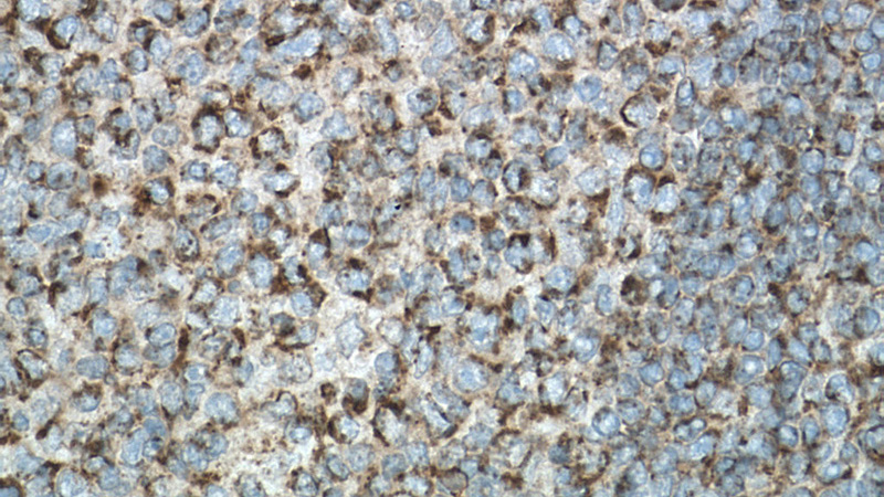 Immunohistochemistry of paraffin-embedded human tonsillitis tissue slide using Catalog No:115295(SLAMF6 Antibody) at dilution of 1:200 (under 40x lens). heat mediated antigen retrieved with Tris-EDTA buffer(pH9).