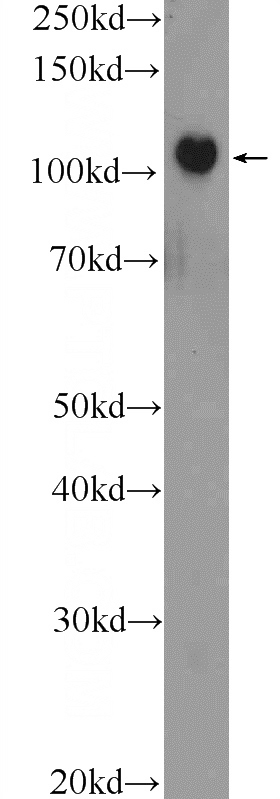 HEK-293 cells were subjected to SDS PAGE followed by western blot with Catalog No:114234(PRPF6 Antibody) at dilution of 1:1000