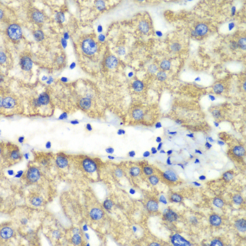 Immunohistochemistry - ABAT Polyclonal Antibody 