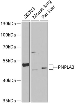 Western blot - PNPLA3 Polyclonal Antibody 