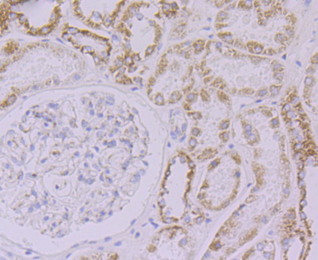 Fig4:; Immunohistochemical analysis of paraffin-embedded human kidney tissue using anti-NDUFB8 antibody. The section was pre-treated using heat mediated antigen retrieval with Tris-EDTA buffer (pH 8.0-8.4) for 20 minutes.The tissues were blocked in 5% BSA for 30 minutes at room temperature, washed with ddH; 2; O and PBS, and then probed with the primary antibody ( 1/50) for 30 minutes at room temperature. The detection was performed using an HRP conjugated compact polymer system. DAB was used as the chromogen. Tissues were counterstained with hematoxylin and mounted with DPX.