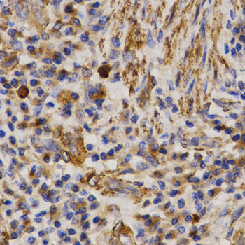 Immunohistochemistry - MMP25 Polyclonal Antibody 