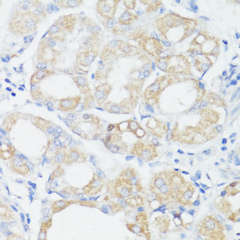 Immunohistochemistry - PRR11 Polyclonal Antibody 
