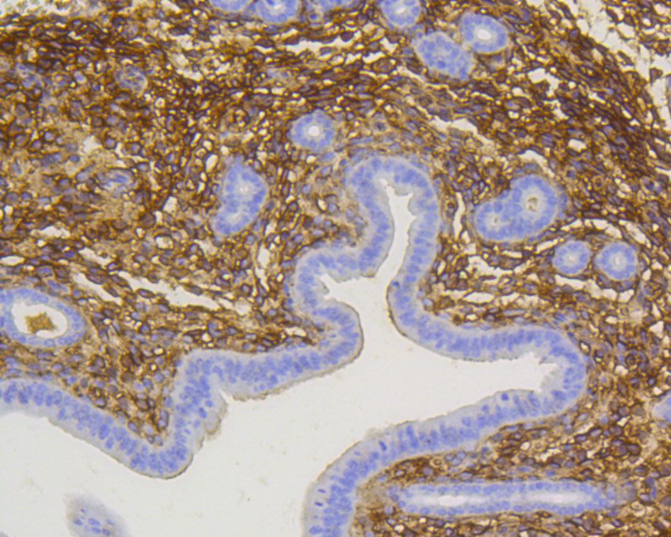 Fig8:; Immunohistochemical analysis of paraffin-embedded mouse uterus tissue using anti-p75 NGF Receptor antibody. The section was pre-treated using heat mediated antigen retrieval with Tris-EDTA buffer (pH 8.0-8.4) for 20 minutes.The tissues were blocked in 5% BSA for 30 minutes at room temperature, washed with ddH; 2; O and PBS, and then probed with the primary antibody ( 1/200) for 30 minutes at room temperature. The detection was performed using an HRP conjugated compact polymer system. DAB was used as the chromogen. Tissues were counterstained with hematoxylin and mounted with DPX.