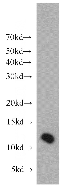 HeLa cells were subjected to SDS PAGE followed by western blot with Catalog No:116099(TMEM141 antibody) at dilution of 1:500