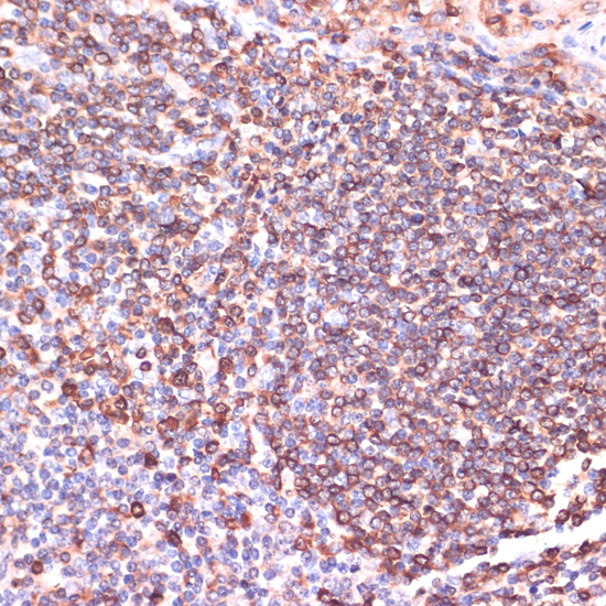 Immunohistochemistry - TPD52 Polyclonal Antibody 