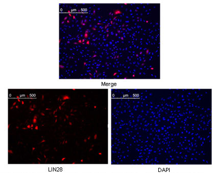 Confocal immunofluorescence analysis of methanol fixed Hela cells were transfected with pMX construct of human LIN28, cells were analyzed ~62 hours after transfection.
