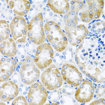 Immunohistochemistry - GNRH2 Polyclonal Antibody 