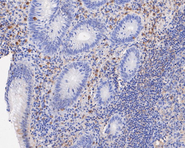 Fig4:; Immunohistochemical analysis of paraffin-embedded human appendix tissue using anti-Themis antibody. The section was pre-treated using heat mediated antigen retrieval with sodium citrate buffer (pH 6.0) for 20 minutes. The tissues were blocked in 5% BSA for 30 minutes at room temperature, washed with ddH; 2; O and PBS, and then probed with the primary antibody ( 1/50) for 30 minutes at room temperature. The detection was performed using an HRP conjugated compact polymer system. DAB was used as the chromogen. Tissues were counterstained with hematoxylin and mounted with DPX.