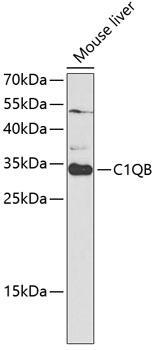 Western blot - C1QB Polyclonal Antibody 
