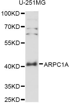 Western blot - ARPC1A Polyclonal Antibody 