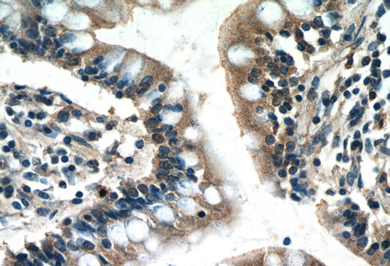 Immunohistochemistry of paraffin-embedded human small intestine tissue slide using Catalog No:116583(USHBP1 Antibody) at dilution of 1:50 (under 40x lens)