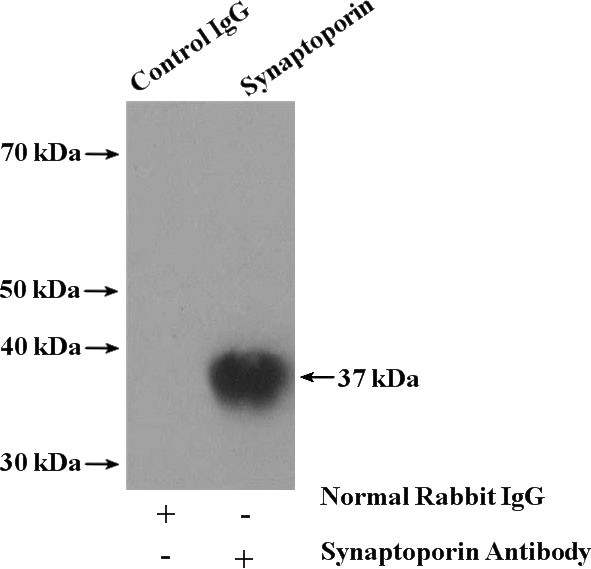 IP Result of anti-SYNPR (IP:Catalog No:115770, 4ug; Detection:Catalog No:115770 1:500) with mouse brain tissue lysate 5200ug.