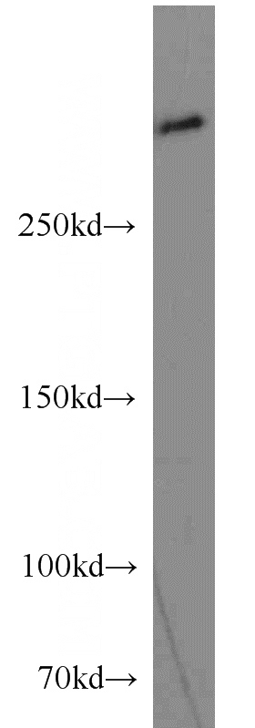 HepG2 cells were subjected to SDS PAGE followed by western blot with Catalog No:113308(NOTCH1 antibody) at dilution of 1:500