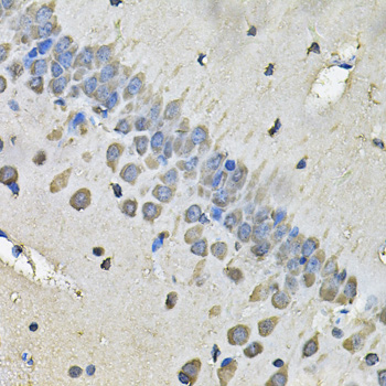 Immunohistochemistry - MYH1 Polyclonal Antibody 