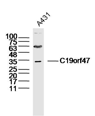 Fig1: Sample: A431 Cell(Human)Lysate at 40 ug; Primary: Anti-C19orf47 at 1/300 dilution; Secondary: IRDye800CW Goat Anti-Rabbit IgG at 1/20000 dilution; Predicted band size: 45kD; Observed band size: 33kD