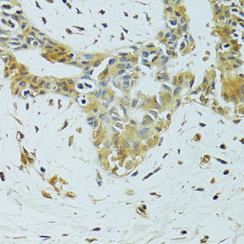 Immunohistochemistry - METTL13 Polyclonal Antibody 