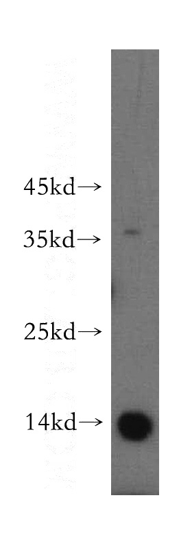 HeLa cells were subjected to SDS PAGE followed by western blot with Catalog No:113814(PHF5A antibody) at dilution of 1:500