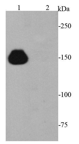 Fig1: Western blot analysis of CRISPR-Cas9 on 293T cell lysates using anti-CRISPR-Cas9 antibody at 1/5000 dilution. Lane 1: CRISPR-Cas9 transfected 293 cells lysate Lane 2: Non-transfected 293 cells lysate