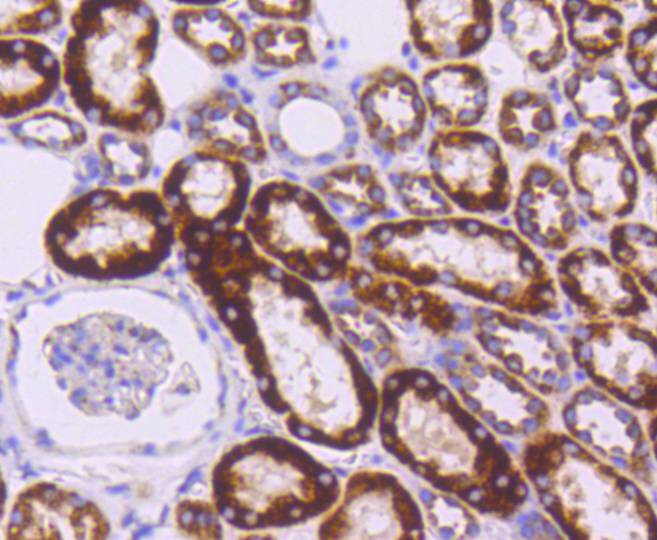 Fig6:; Immunohistochemical analysis of paraffin-embedded human kidney tissue using anti-Sonic Hedgehog Protein antibody. Counter stained with hematoxylin.