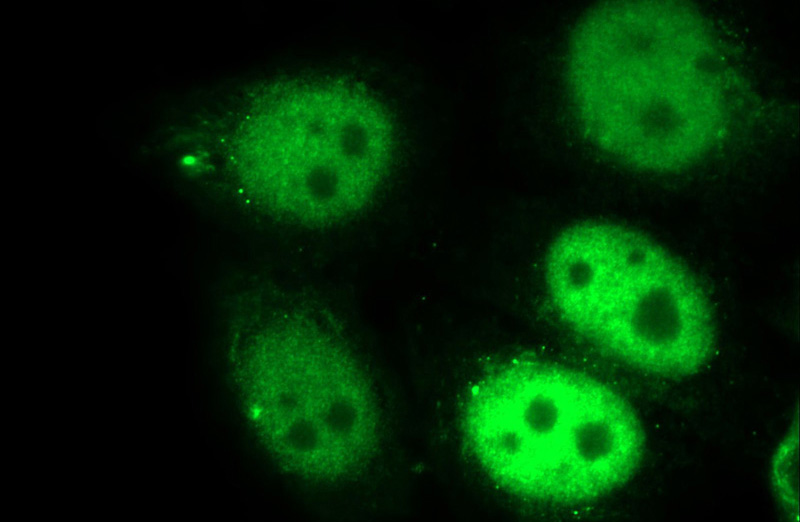 Immunofluorescent analysis of HepG2 cells using Catalog No:115290(SKP2 Antibody) at dilution of 1:25 and Alexa Fluor 488-congugated AffiniPure Goat Anti-Rabbit IgG(H+L)