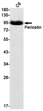 Western blot detection of Periostin in C6 cell lysates using Periostin Rabbit mAb(1:1000 diluted).Predicted band size:93kDa.Observed band size:93kDa.