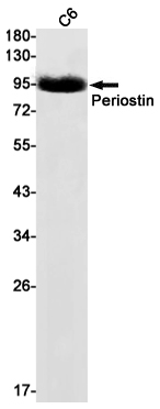 Western blot detection of Periostin in C6 cell lysates using Periostin Rabbit mAb(1:1000 diluted).Predicted band size:93kDa.Observed band size:93kDa.