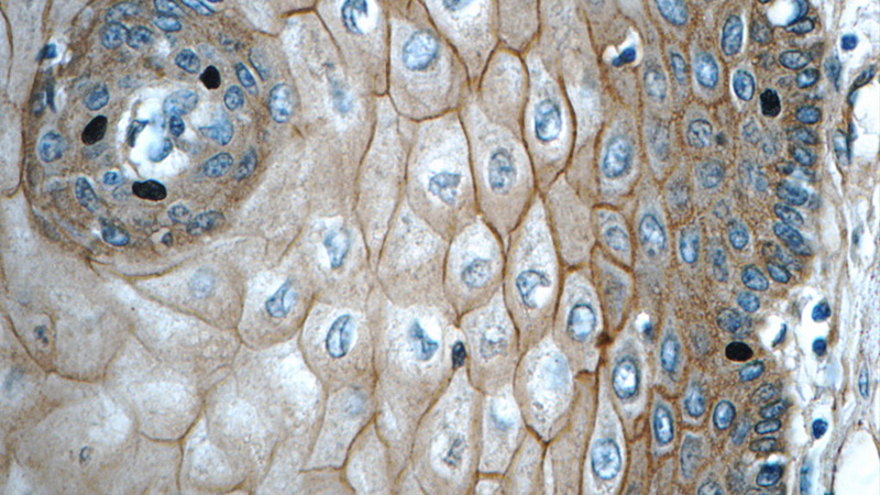 Immunohistochemistry of paraffin-embedded human oesophagus tissue slide using Catalog No:110985(GJB6 Antibody) at dilution of 1:50 (under 40x lens)