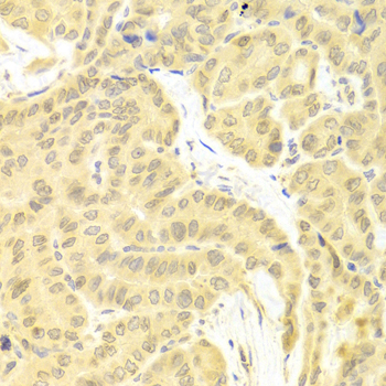 Immunohistochemistry - CFLAR Polyclonal Antibody 