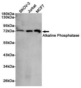 Western blot analysis of extracts from SKOV-3, Jurkat and MCF7 cells using Alkaline Phosphatase Rabbit pAb at 1:1000 dilution. Predicted band size: 57kDa. Observed band size: 70kDa.