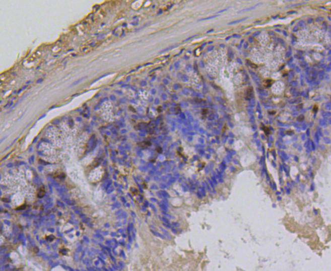 Fig4:; Immunohistochemical analysis of paraffin-embedded mouse colon cancer tissue using anti-Phospho-Histone H1.3(T17)+Histone H1.4(T17) antibody. Counter stained with hematoxylin.