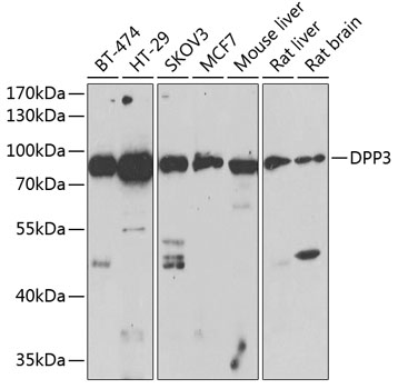 Western blot - DPP3 Polyclonal Antibody 