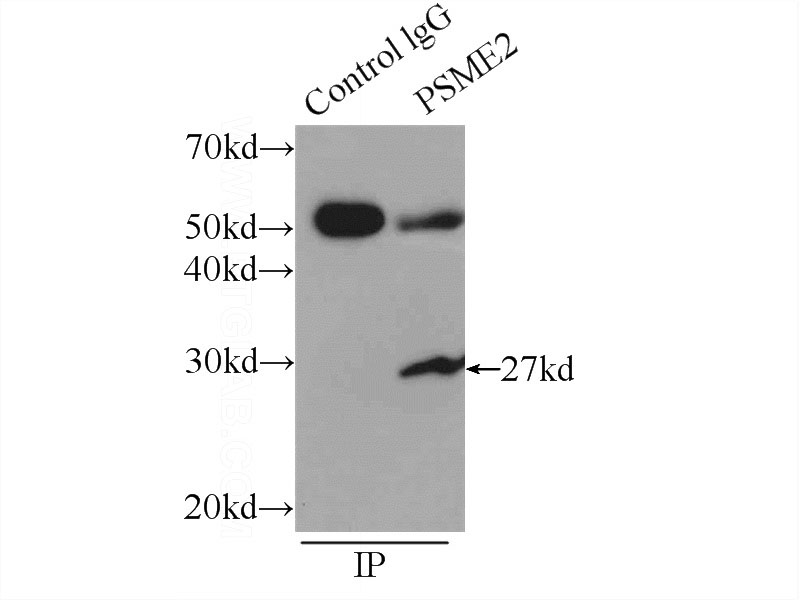 IP Result of anti-PSME2 (IP:Catalog No:114247, 4ug; Detection:Catalog No:114247 1:500) with MCF-7 cells lysate 2000ug.