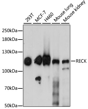 Western blot - RECK Polyclonal Antibody 