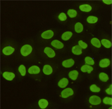 Immunocytochemistry staining of HeLa cells fixed with 4% Paraformaldehyde and using anti-KAP1 / TIF1 beta mouse mAb (dilution 1:100).