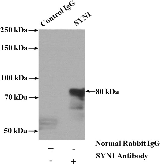 IP Result of anti-SYN1-Specific (IP:Catalog No:115763, 4ug; Detection:Catalog No:115763 1:3000) with rat brain tissue lysate 4000ug.