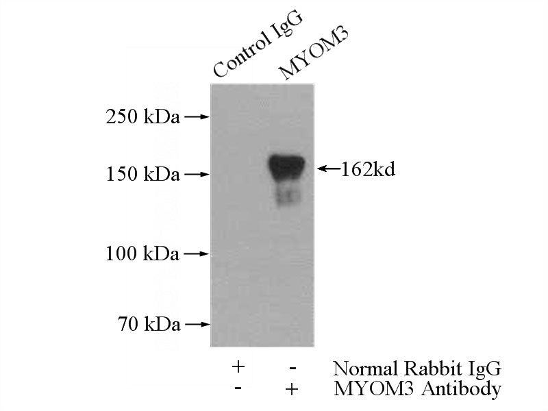 IP Result of anti-MYOM3 (IP:Catalog No:112994, 4ug; Detection:Catalog No:112994 1:700) with mouse skeletal muscle tissue lysate 3600ug.