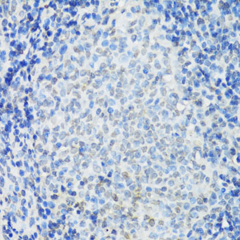Immunohistochemistry - IKBKE Polyclonal Antibody 