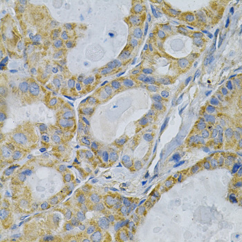 Immunohistochemistry - TLR7 Polyclonal Antibody 