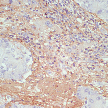 Immunohistochemistry - COL1A1 Polyclonal Antibody 