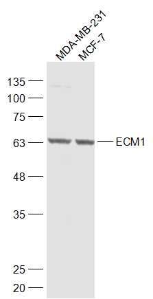 Fig4: Sample:; MDA-MB-231(Mouse) Cell Lysate at 30 ug; MCF-7(Human) Cell Lysate at 30 ug; Primary: Anti-ECM1 at 1/1000 dilution; Secondary: IRDye800CW Goat Anti-Rabbit IgG at 1/20000 dilution; Predicted band size: 59 kD; Observed band size: 65 kD
