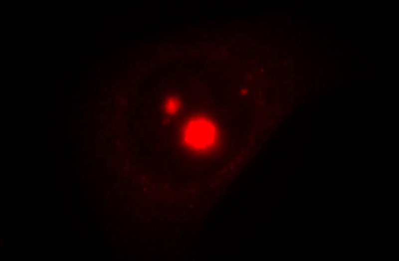 Immunofluorescent analysis of Hela cells, using TXK antibody Catalog No:116505 at 1:25 dilution and Rhodamine-labeled goat anti-rabbit IgG (red).