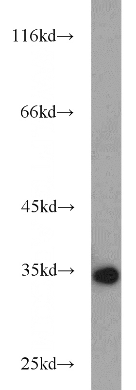 HeLa cells were subjected to SDS PAGE followed by western blot with Catalog No:108096(ANXA5 antibody) at dilution of 1:800